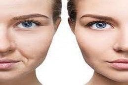 Botox Injection for wrinkles Clinic in Dubai