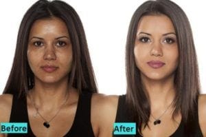 Glutathione Skin Whitening Injections in Dubai & Abu Dhabi