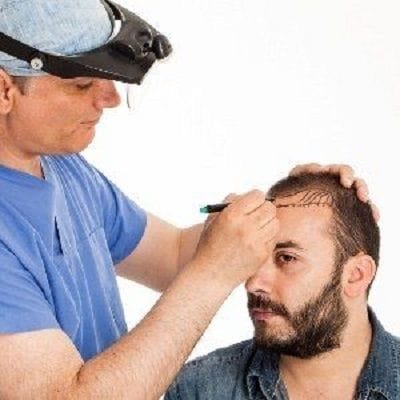 FUE Hair Transplant in Dubai Abu Dhabi Sharjah