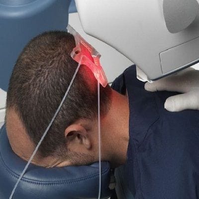 Robotic Hair Transplant in Dubai Abu Dhabi Sharjah