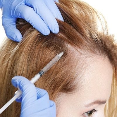 PRP hair treatment Cost Dubai & Abu Dhabi