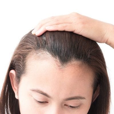 Natural Hairline Treatment in Dubai, Abu Dhabi & Sharjah