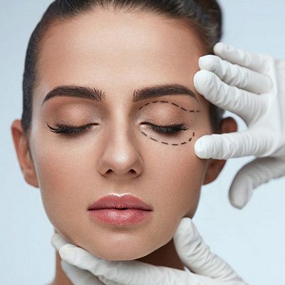 Types of Eyelid Surgery and Effective Cost Dubai & Abu Dhabi
