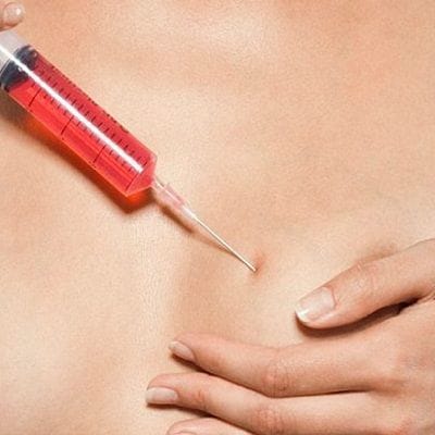 Body Fillers Injections in Dubai, Abu Dhabi & Sharjah