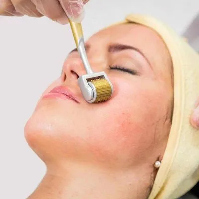 Derma Rollers Treatment in Dubai