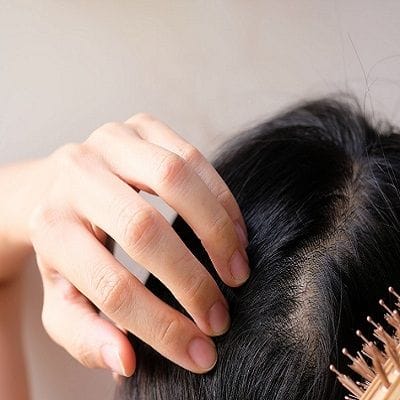 Hair Loss & Nail Disorders Treatment