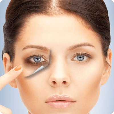 Causes Of Dark Circles And Effective Treatments