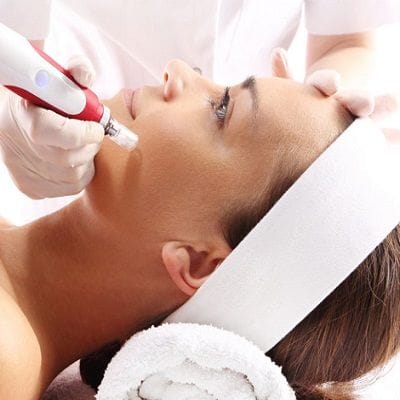 RF fractional Microneedling is a Perfect Skincare Solution