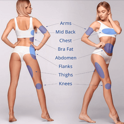 J plasma for Thighs & Arms Treatment in Dubai, Abu Dhabi & Sharjah