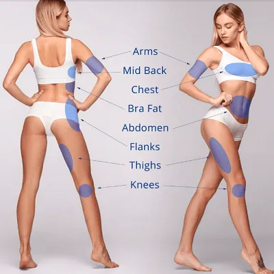 J plasma for Thighs & Arms Treatment in Dubai