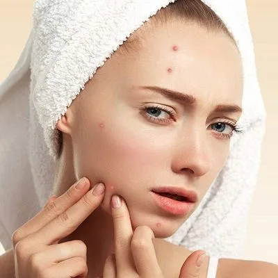 Pimples Treatment in Dubai | Pimple Cortisone Injection