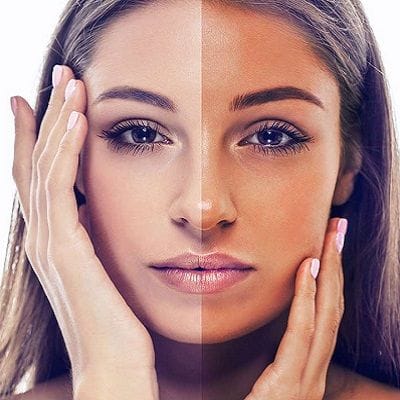 Tan Removal Treatment in Dubai & Abu Dhabi