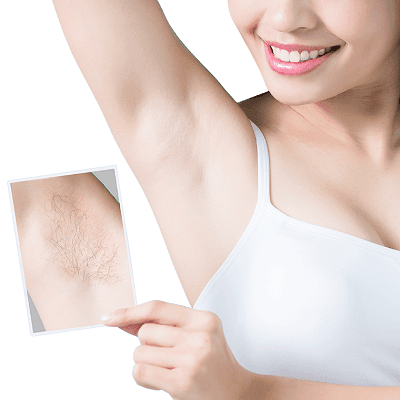 Underarm Laser Hair Removal