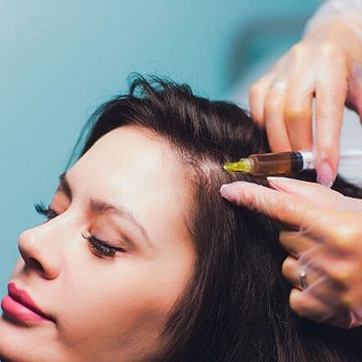 What You Should Know About PRP for Hair Loss Dubai & Abu Dhabi