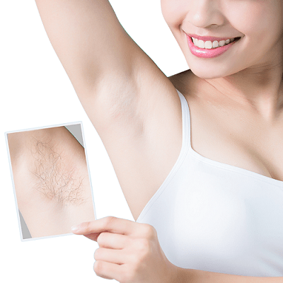 The TRUTH About Laser Hair Removal My Experience  How to lighten underarms   YouTube