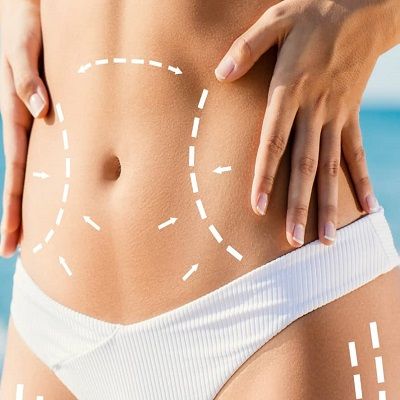 Things to Know About Body Contouring Treatments