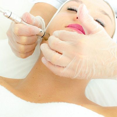 What Patients Should Know Before Getting Microdermabrasion