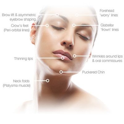 Botulinum Toxin Injections