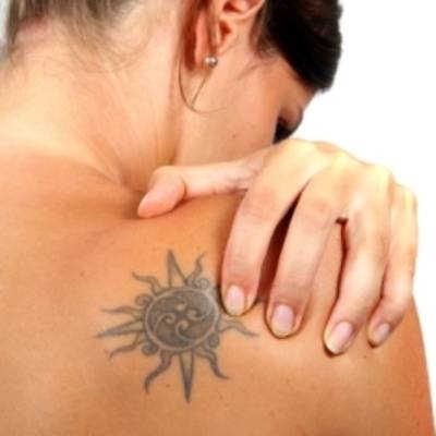 Painless Laser Tattoo Removal Dubai
