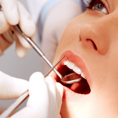 Dental Tooth Filling in Dubai