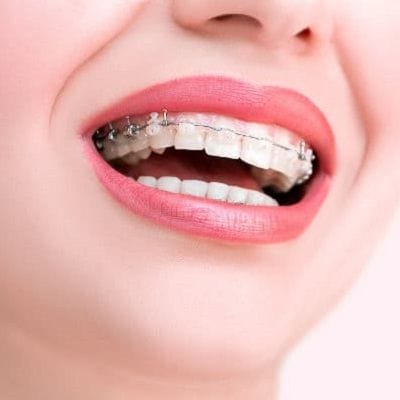 Orthodontists in Dubai