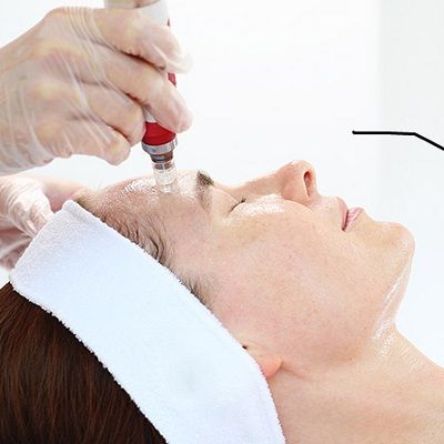 How Long Does Mesotherapy for Face Last in Dubai & Abu Dhabi UAE