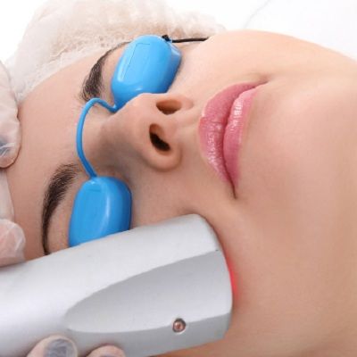 Microneedling Treatment for Acne Scars Cost in Dubai Dynamic Clinic