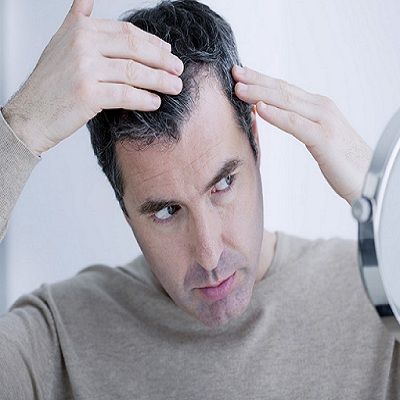 Hair Transplant Surgery For Diffuse Thinning in Dubai, Abu Dhabi Cost