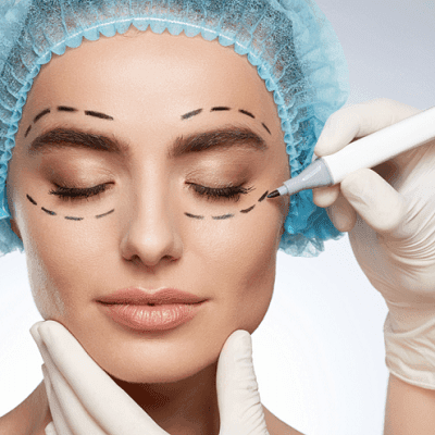 Upper Eyelid Surgery Cost Dubai