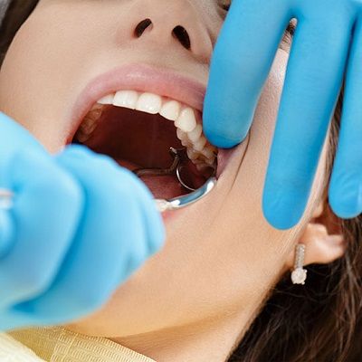 Wisdom Tooth Extraction in Dubai