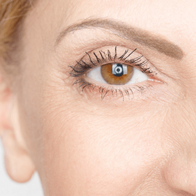 How to Tighten Eyelid Skin Without Surgery