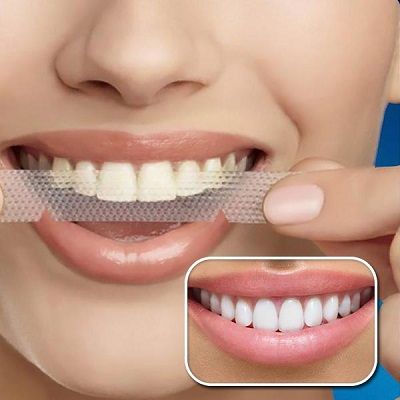 Best Teeth Whitening Strips in Dubai & Abu Dhabi Whitening Strip Cost