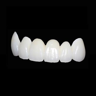 Best Zirconia Crowns in Dubai & Abu Dhabi Zirconia Crown Cost