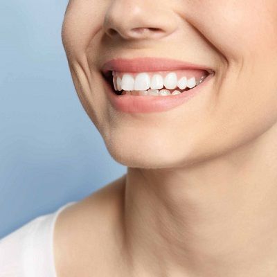 Costo del tratamiento de la sonrisa gingival