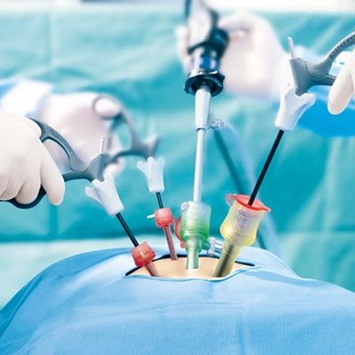 Best Laparoscopic Surgery in Dubai & Abu Dhabi Laparoscopic UAE Cost