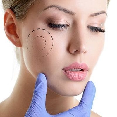 How Long Does Cheek Augmentation Last in Dubai Enfield Royal Clinic