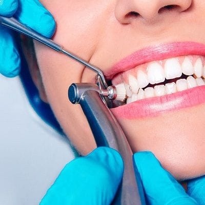 Teeth Cleaning Cost in Dubai