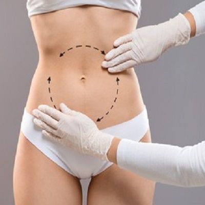 Everything you need to know about Lipomatic surgery in Dubai