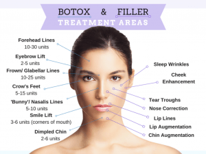 Difference Between Botox and fillers