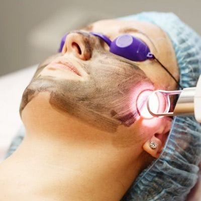 Carbon Spectra Laser For The Face in Dubai