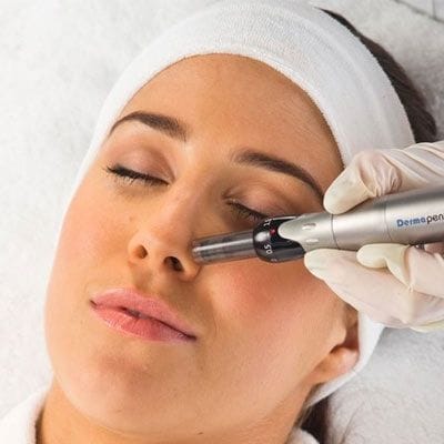 Dermapen Treatment Price in Dubai