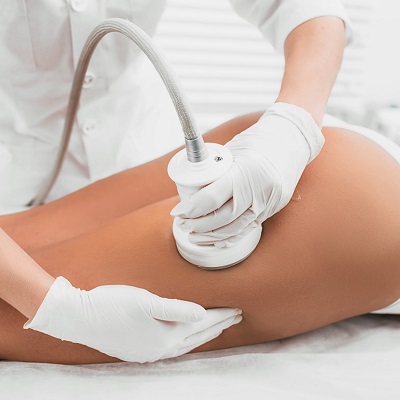 What Is The Best Treatment For Cellulite