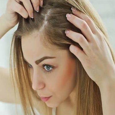 Hair Restoration For Women