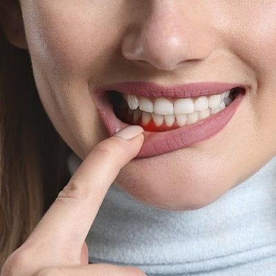 How Long Does Periodontal Treatment Take