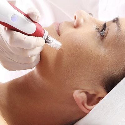 Microneedling Dubai Price