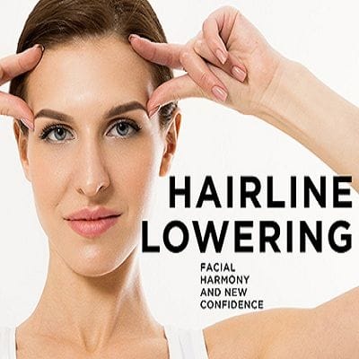 hairline lowering