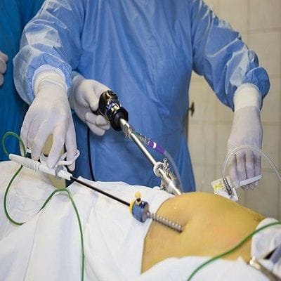 Bariatric Surgery In Dubai