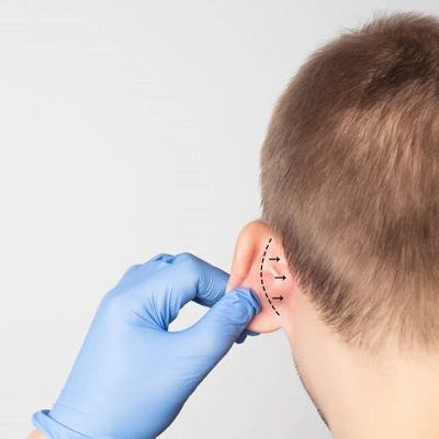 Cosmetic Ear Surgery for Children and Adults