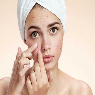 Best dermatologist in dubai for acne