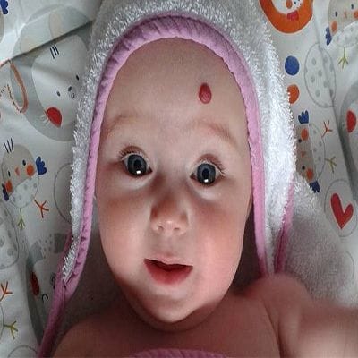 When to Worry about a Mole on a Child?